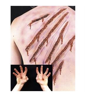 Whip and Spike Scars