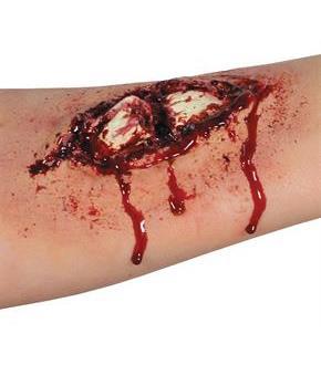 Broken Bone Ez Fx Kit