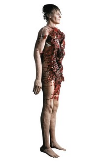 Autopsy Body