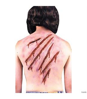 Whip Spike Scars