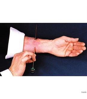 Needle Thru Arm