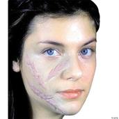 Woochie Scar Set 3