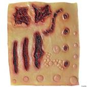 Latex Scar Sheet